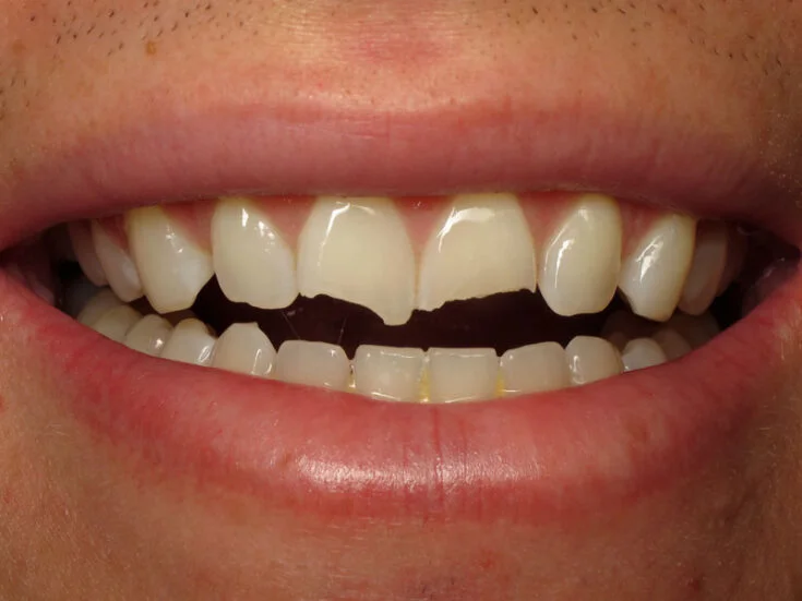 Before