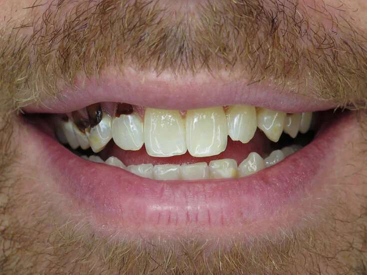 Before