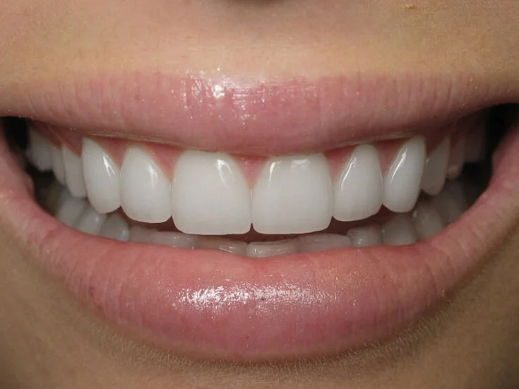 After